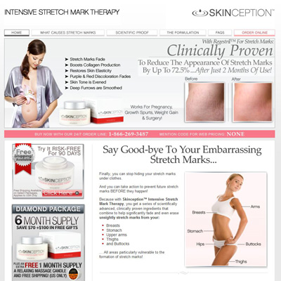 best stretch mark prevention cream